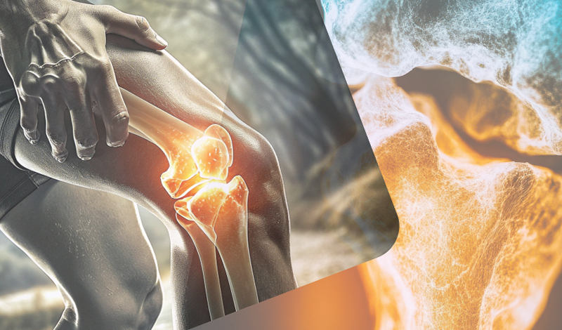 Benefici sulle articolazioni