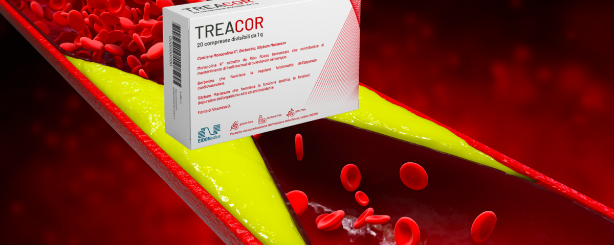 treacor flusso