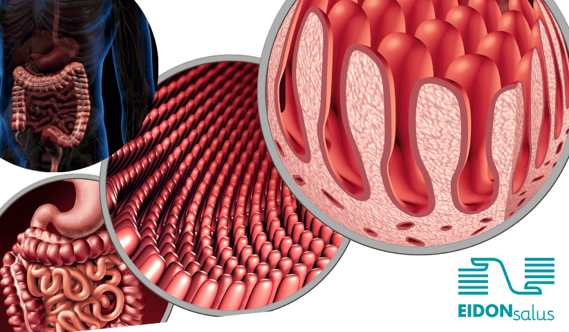 colon irritabile