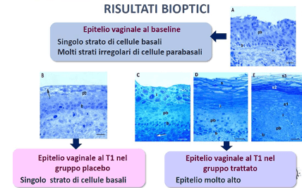 Risultati bioptici - EIDON salus