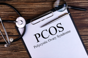 pcos