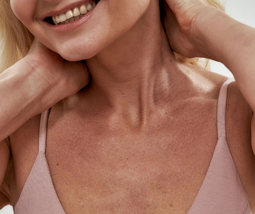 Skin spots Skin spots