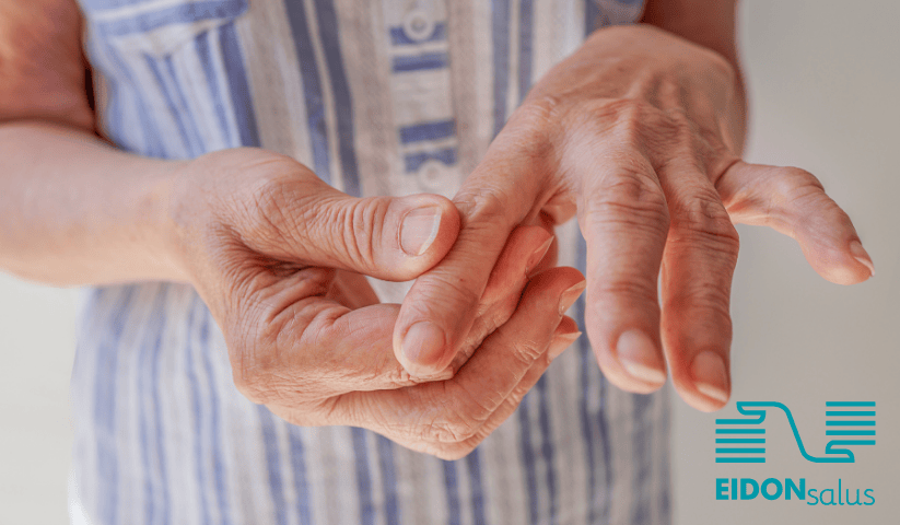 effetti dell'artrosi sulle articolazioni della mano